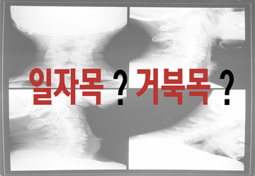 목의 변형으로 인한 신체 적신호