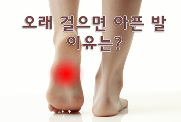 오래 걸을 때 쉽게 아픈 발? 평발에 대한 오해