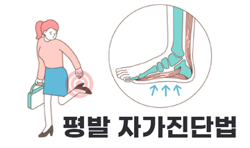 평발 자가진단법