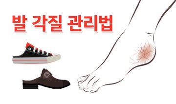발 뒤꿈치 각질 관리하는 법