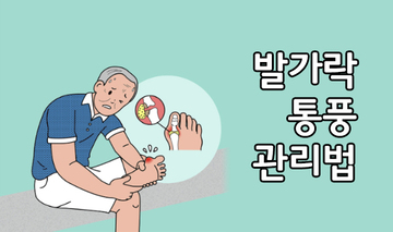 발가락 통풍 관리법