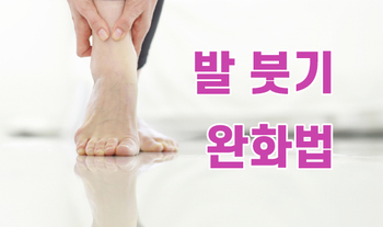 발 붓기 완화법