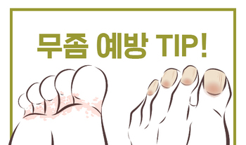 무좀 예방 TIP !!